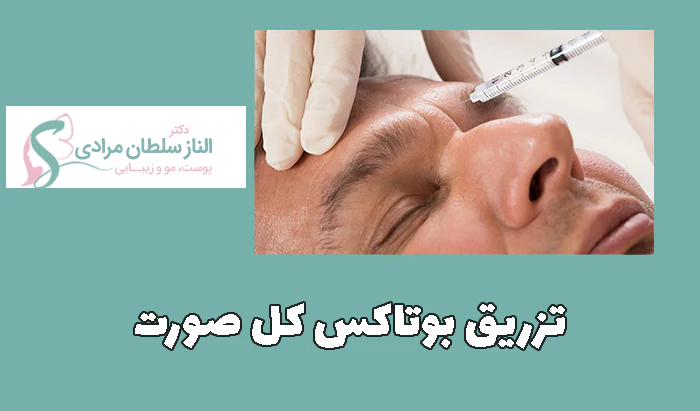 تزریق بوتاکس کل صورت