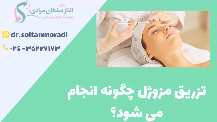 تزریق مزوژل چگونه انجام می شود؟
