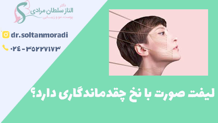 لیفت صورت با نخ چقدماندگاری دارد؟