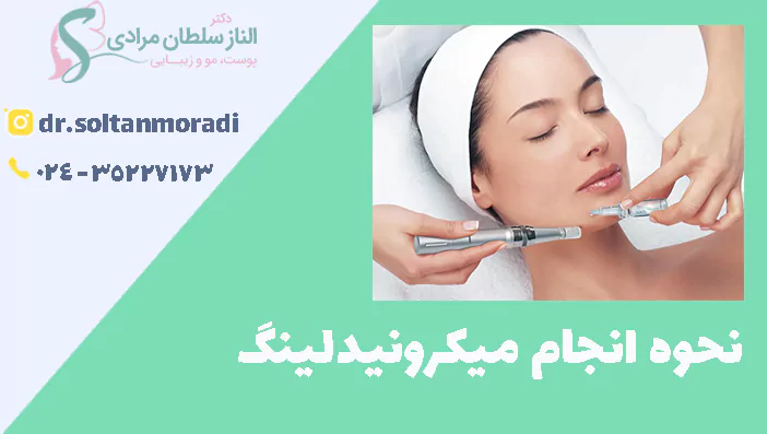 نحوه انجام میکرونیدلینگ
