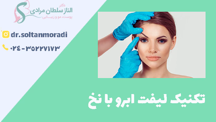 تکنیک لیفت ابرو با نخ