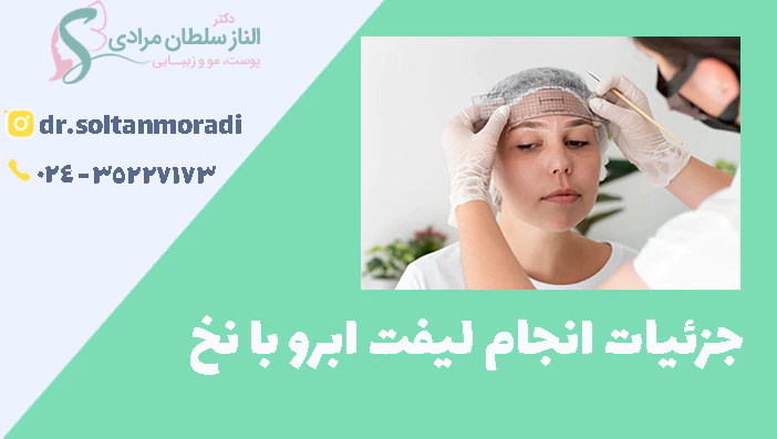 جزئیات انجام لیفت ابرو با نخ