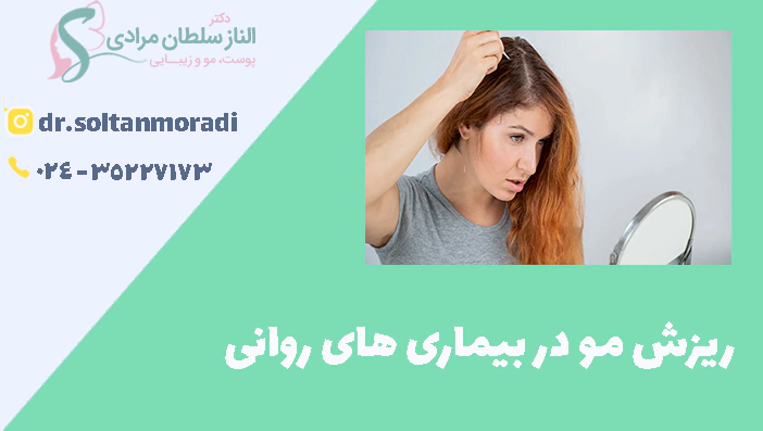ریزش مو در بیماری های روانی