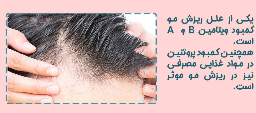 علل ریزش مو