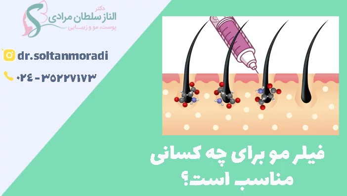 فیلر مو برای چه کسانی
مناسب است؟