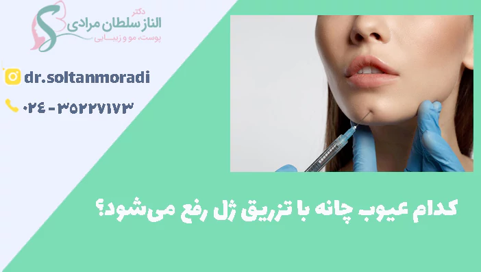 کدام عیوب چانه با تزریق ژل رفع می‌شود؟