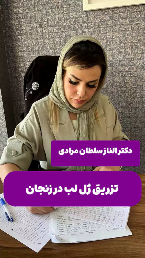 دکتر الناز سلطان مرادی تزریق ژل لب در زنجان