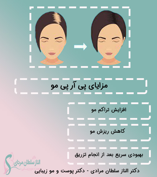 مزایای-پی-آر-پی-مو