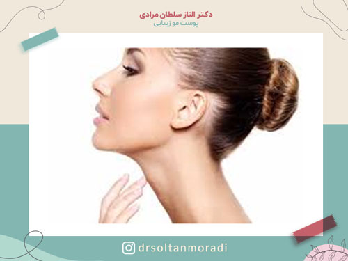 راههای جوانسازی گردن