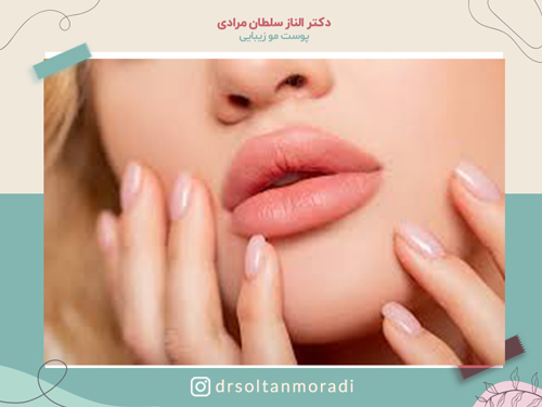 انواع مدل تزریق ژل لب
