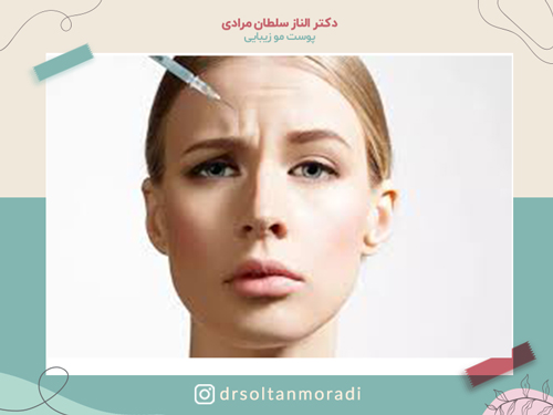 تزریق-بوتاکس-به-پیشانی