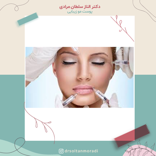 جوانسازی صورت با تزریق فیلر