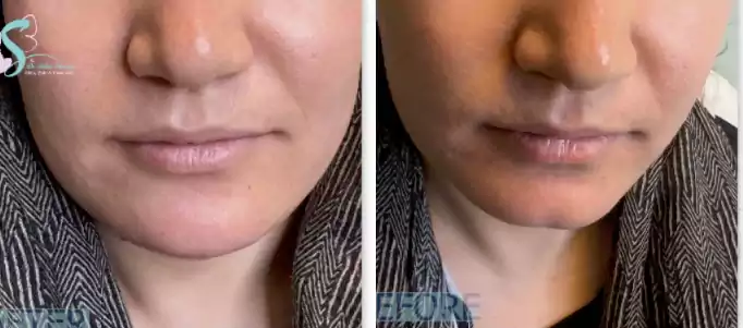زاویه سازی صورت نمونه کار