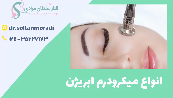  انواع میکرودرم ابریژن