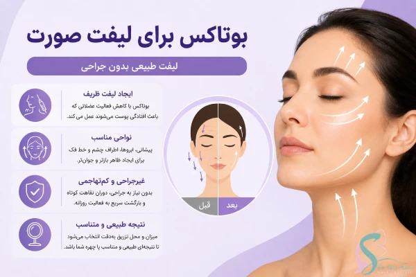 بوتاکس برای لیفت صورت