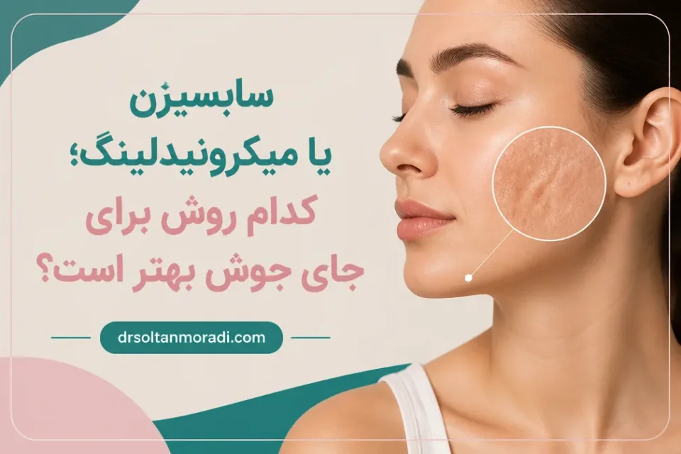نمای توضیحی درباره سابسیژن برای چه نوع جای جوشی مناسب است